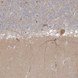 Anti-TRIM2 antibody produced in rabbit 