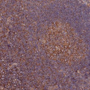 Anti-TRIM26 antibody produced in rabbit 