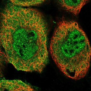 Anti-TRIM26 antibody produced in rabbit 