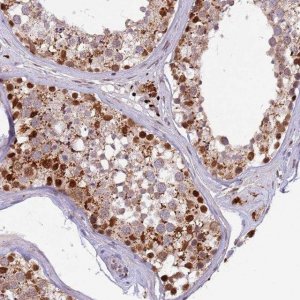 Anti-TRIM27 antibody produced in rabbit 