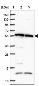 Anti-TRIM27 antibody produced in rabbit 