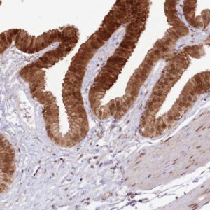 Anti-TRIM32 antibody produced in rabbit HPA050060-100UL