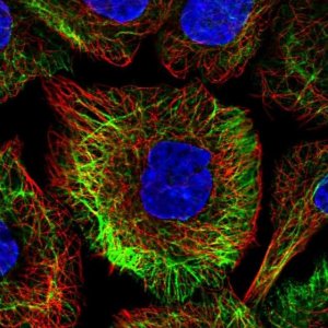 Anti-TRIM32 antibody produced in rabbit HPA050060-100UL