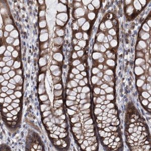 Anti-TRIM38 antibody produced in rabbit 