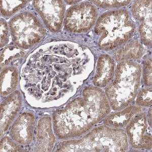 Anti-TRMU antibody produced in rabbit 