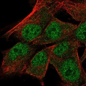 Anti-TRNAU1AP antibody produced in rabbit 