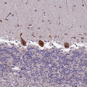 Anti-TROAP antibody produced in rabbit 