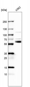 Anti-TROVE2 antibody produced in rabbit 