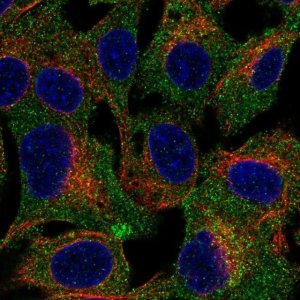 Anti-TRPC4AP antibody produced in rabbit 