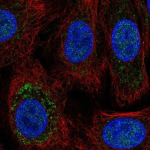 Anti-TRPC6 antibody produced in rabbit 