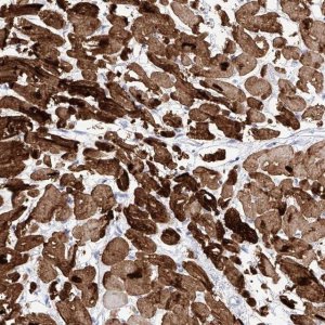 Anti-TRPC7 antibody produced in rabbit 