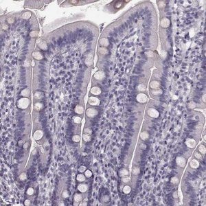 Anti-TRPM1 antibody produced in rabbit 