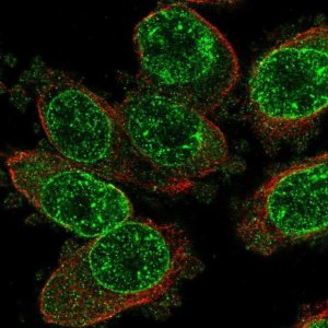 Anti-TRPM2 antibody produced in rabbit 