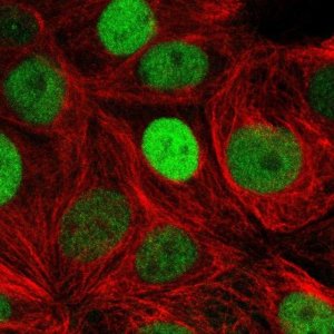 Anti-TRPS1 antibody produced in rabbit 