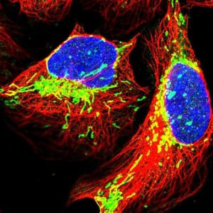 Anti-TRPT1 antibody produced in rabbit 