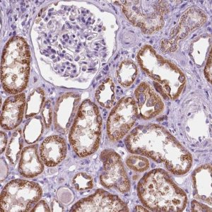 Anti-TRPV5 antibody produced in rabbit 