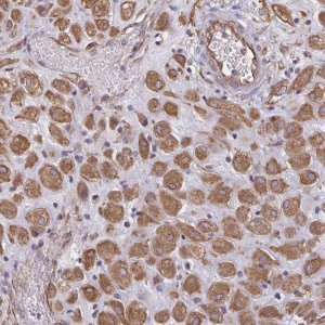 Anti-TRPV6 antibody produced in rabbit 