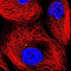Anti-TRUB1 antibody produced in rabbit 