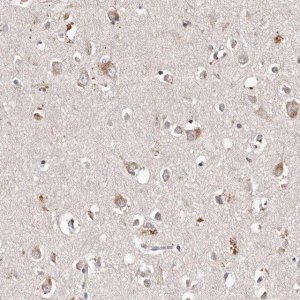 Anti-TSC2 antibody produced in rabbit 