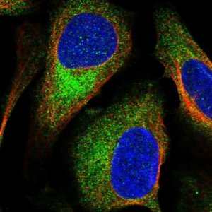 Anti-TSC2 antibody produced in rabbit 