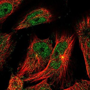 Anti-TSEN2 antibody produced in rabbit 