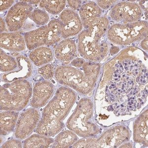 Anti-TSEN54 antibody produced in rabbit 
