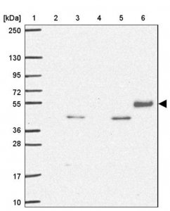 Anti-TSEN54 antibody produced in rabbit 