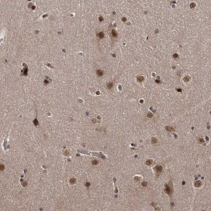 Anti-TSHZ2 antibody produced in rabbit 