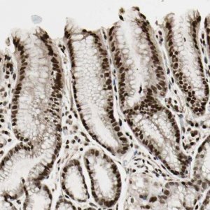 Anti-TSHZ3 antibody produced in rabbit 