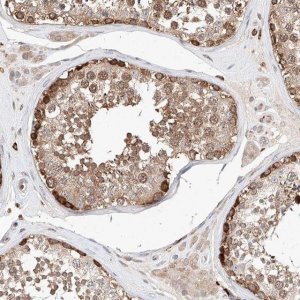 Anti-TSNAX antibody produced in rabbit 