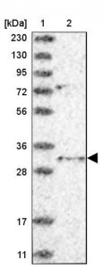 Anti-TSNAX antibody produced in rabbit 