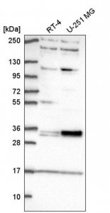 Anti-TSPAN11 antibody produced in rabbit 