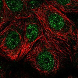 Anti-TSPAN17 antibody produced in rabbit 