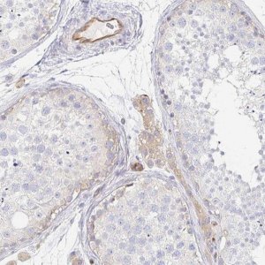Anti-TSPAN19 antibody produced in rabbit 