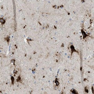 Anti-TSPAN3 antibody produced in rabbit 