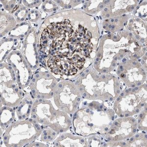 Anti-TSPAN33 antibody produced in rabbit 