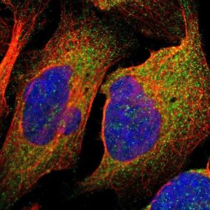 Anti-TSPAN6 antibody produced in rabbit 