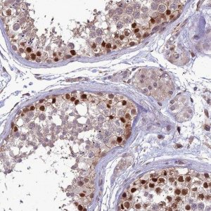 Anti-TSPYL2 antibody produced in rabbit 