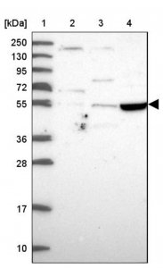 Anti-TSPYL4 antibody produced in rabbit 