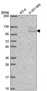 Anti-TSR1 antibody produced in rabbit 