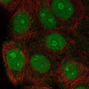Anti-TSSC1 antibody produced in rabbit 