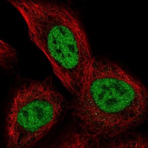 Anti-TSSC4 antibody produced in rabbit 
