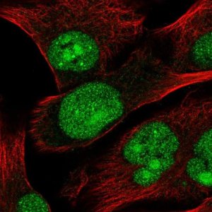 Anti-TSSK3 antibody produced in rabbit 
