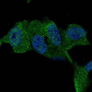 Anti-TTBK1 antibody produced in rabbit 