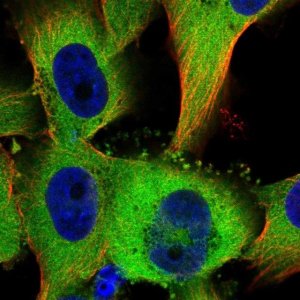 Anti-TTC1 antibody produced in rabbit 