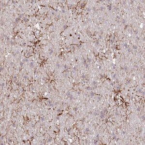 Anti-TTC1 antibody produced in rabbit HPA036557-100UL