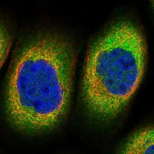 Anti-TTC1 antibody produced in rabbit HPA036557-100UL