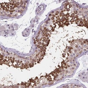 Anti-TTC12 antibody produced in rabbit 
