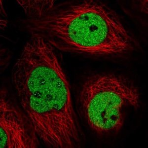 Anti-TTC13 antibody produced in rabbit 