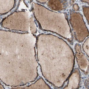 Anti-TTC14 antibody produced in rabbit HPA009295-100UL